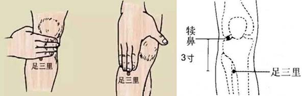 针灸：便秘，一次愈