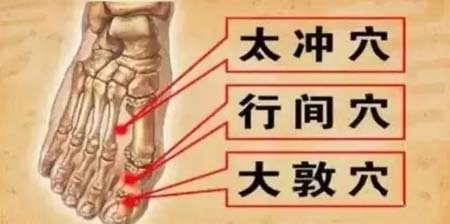针灸：便秘，一次愈