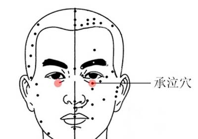 两穴搞定三叉神经痛