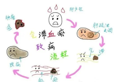 越鞠丸，消散各种结节的特效方