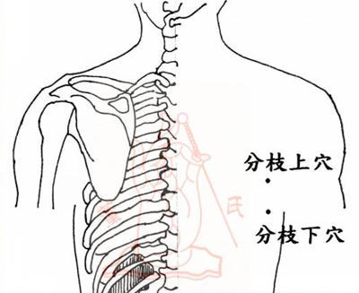董氏奇穴：糖尿病经验处方！