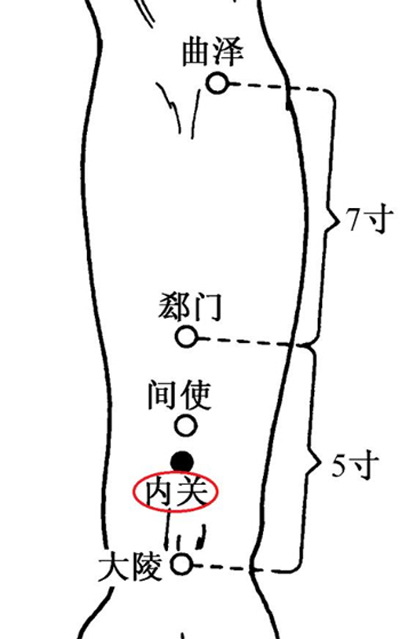 几针痛苦立缓——胃痉挛针灸