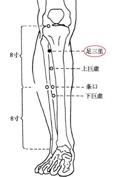 几针痛苦立缓——胃痉挛针灸