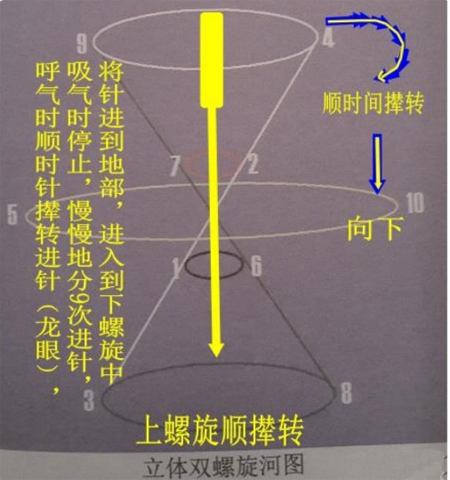 奇脉四针，穴位处方