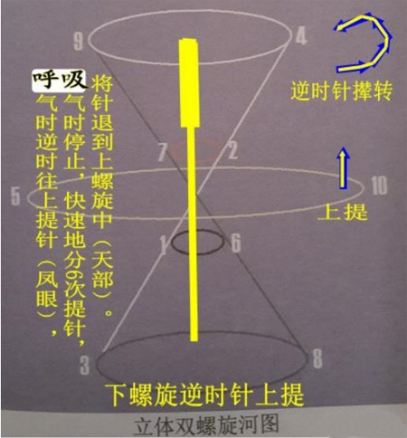 奇脉四针，穴位处方