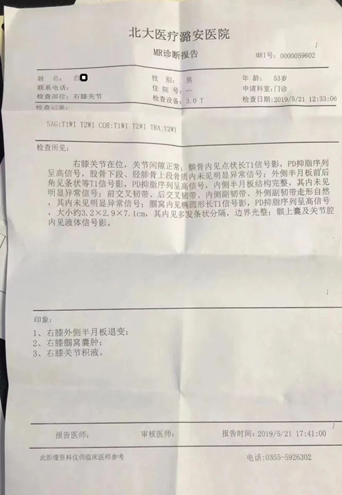 腘窝囊肿医案