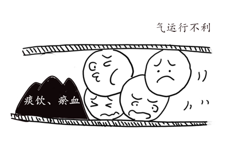 黄芪桂枝五物汤，治麻木第一方！