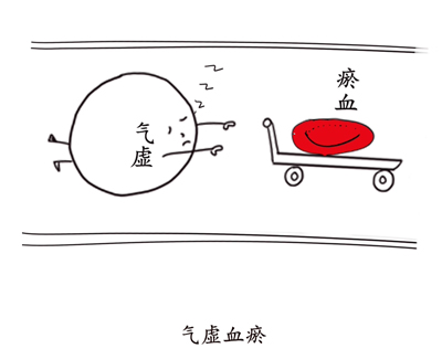 黄芪桂枝五物汤，治麻木第一方！