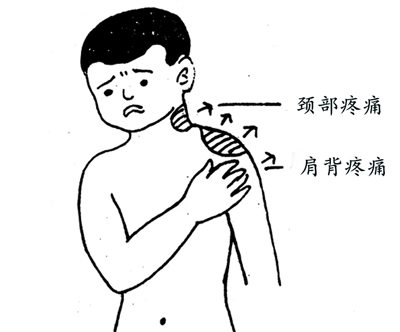 黄芪桂枝五物汤，治麻木第一方！
