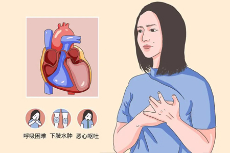 治疗肌痹（硬皮病）医案