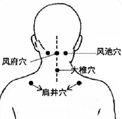 阳后浑身疼该怎么缓解？