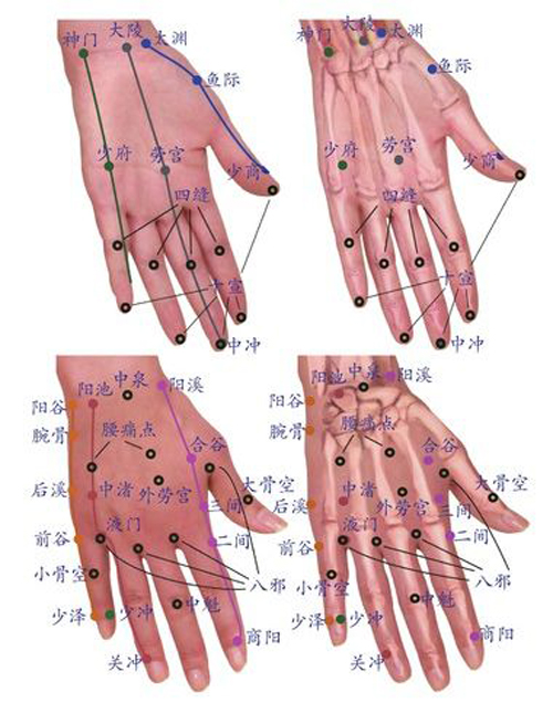 抑郁症的针灸诊治要点