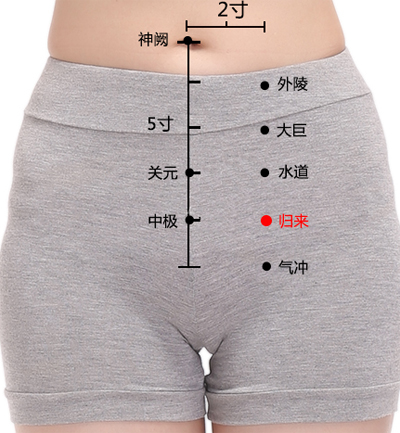 治疗妇科疾病的“阴三针”