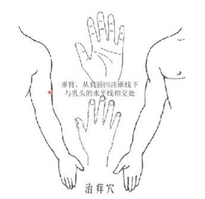 治痒奇穴