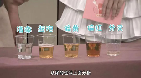 名中医推荐5款祛湿方