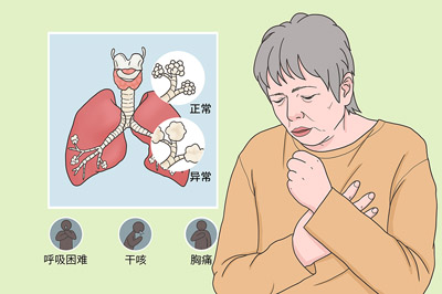 张洪春治间质性肺病经验