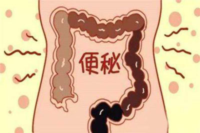 治疗脾虚燥结型便秘经验