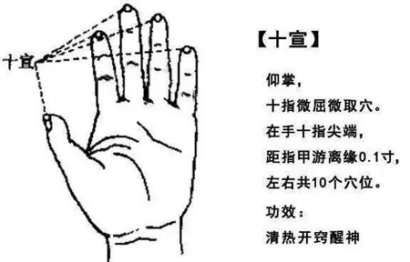 掐“十宣”