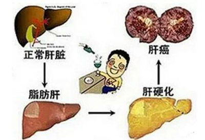 治肝癌用经方，见黑便出即愈