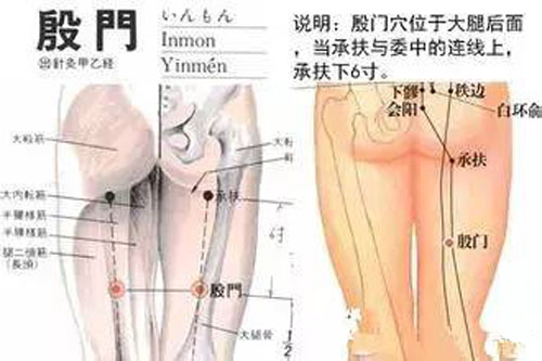 殷门穴：腰痛、下肢痿痹