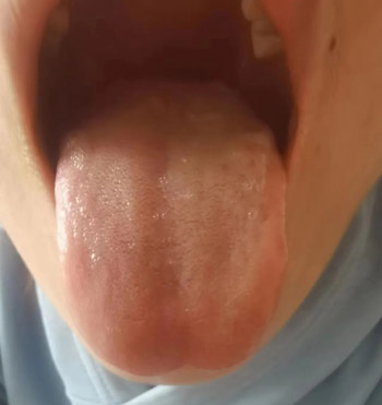 经期淋漓不断病案