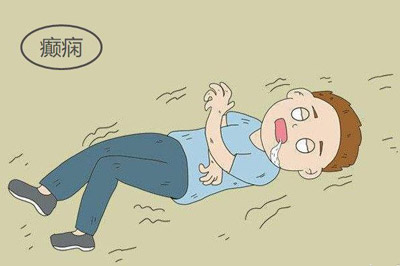 治癫痫名方