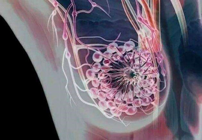 紫草阳和汤加减治溃后期肉芽肿性乳腺炎