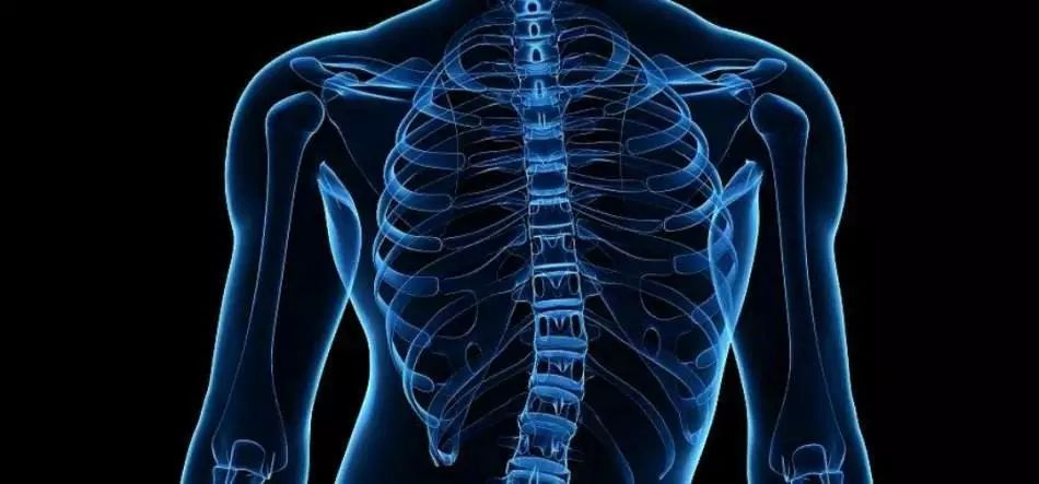 高低肩、长短腿,你脊柱侧弯了吗?(内含评估及瑜伽理疗方法)